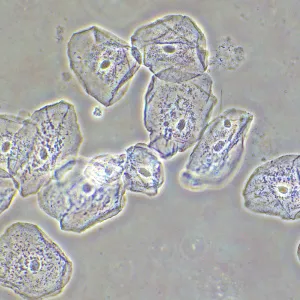Фазово-контрастное устройство MAGUS SPH2, изображение 15